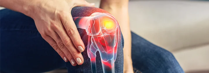 Knee pain shown by a 3D model of an inflamed knee