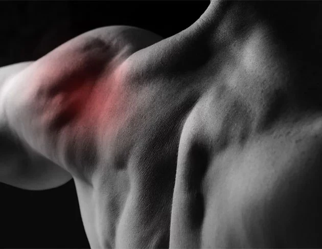 An athlete's shoulder with red highlighting indicating inflammation and pain